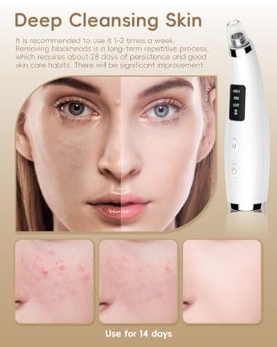 Blackhead Remover Pore Vacuum, Pore Cleaner for Face with 5 Attachments & 3 Suction Levels, USB Rechargeable Facial Blackhead Extractor Tool for Women & Men (Pearl White)
