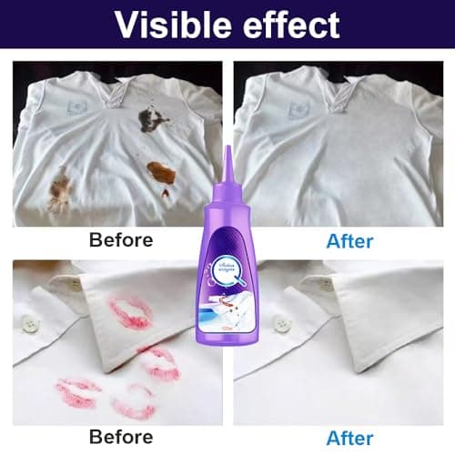 Active Enzyme Laundry Stain Remover, 2025 New White Shirt Garment Stubborn Stain Cleaner Oil Remover, Active Enzyme Clothing Stain Remover Collar Stain Removal Spray (1)