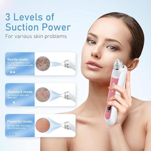 Blackhead Remover Vacuum, USB Interface Type Pore Vacuum, Black Head Extractions Tool with Camera for Men and Women Pore Cleaner, 3 Adjustment Modes & 6 Suction Heads(Light Pink)