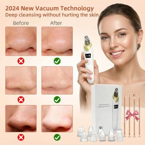 2026 Pore Vacuum, USB Rechargeable Blackhead Remover Vacuum,3 Levels Adjustable Pore Vacuum Blackhead Remover, with 5 Suction Power,6 Probes,Face Vacuum Pore Cleanser for Women & Men-Gold