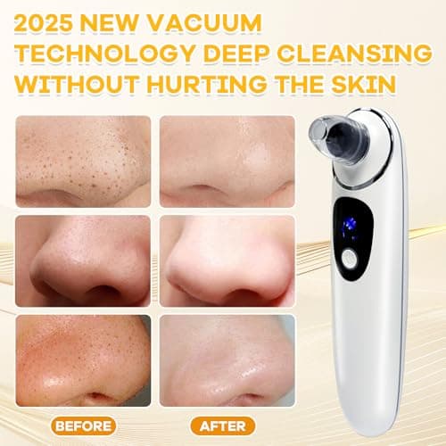 2026 Pore Vacuum with Camerafor, USB Rechargeable Blackhead Remover Vacuum,3 Levels Adjustable Pore Vacuum Blackhead Remover, 6 Suction Heads,Face Vacuum Pore Cleanser for Women & Men-White