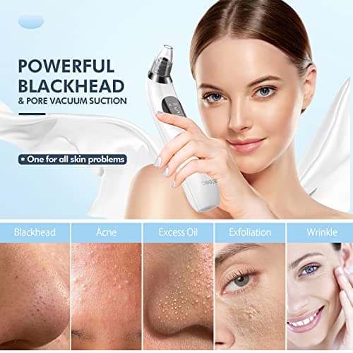 Blackhead Remover Pore Vacuum, Upgraded Black Head Remover for Face, Electric Acne Comedone Whitehead Extractor Tools-5 Suction Power, 5 Probes, USB Rechargeable Pimple Popper Tool Kit