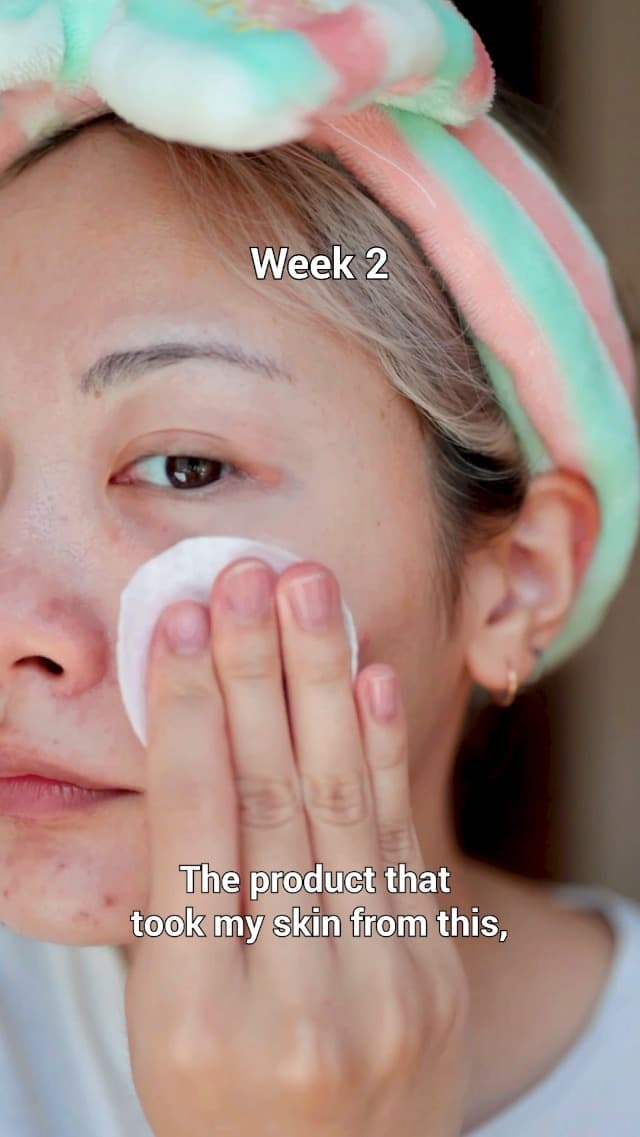 Dual-Textured Facial Pad with 4.5% AHA Lactic Acid, 0.45% BHA Salicylic Acid - For All, Korean Skin Care, 70 Pads, 1 Pack medicube Toner Pads Zero Pore Pad 2.0 for Exfoliation and Pore Care B09V7Z4TJG