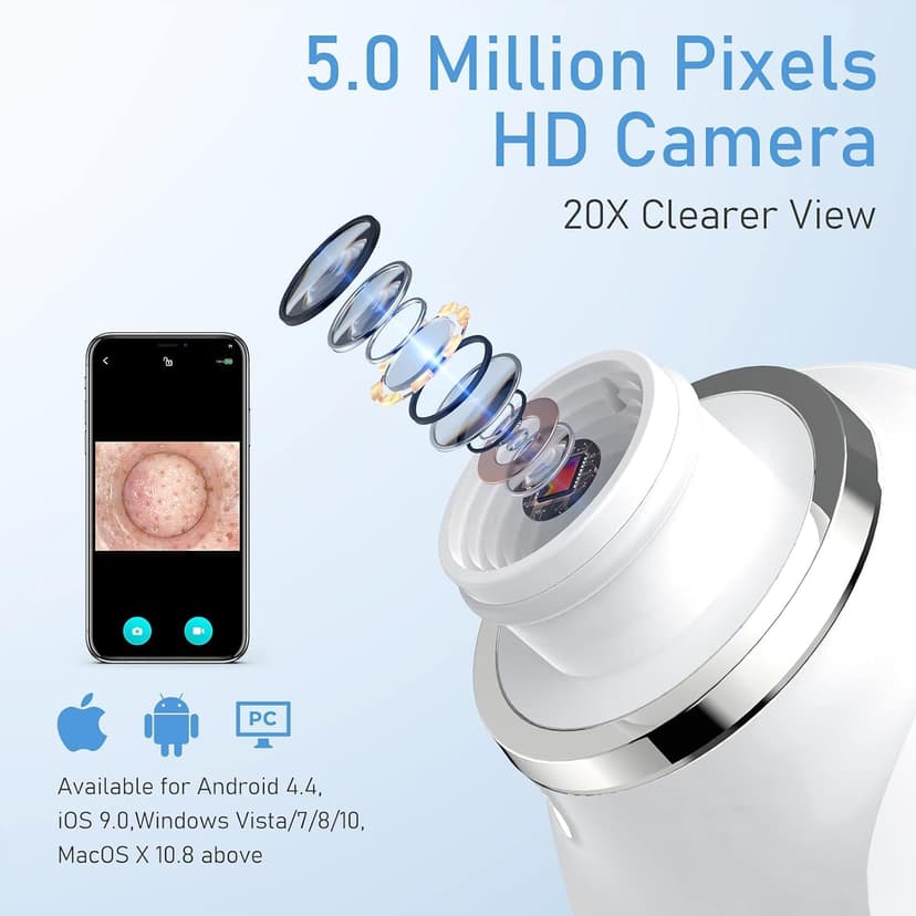 Blackhead Remover Vacuum, USB Interface Type Pore Vacuum, Black Head Extractions Tool with Camera for Men and Women Pore Cleaner, 3 Adjustment Modes & 6 Suction Heads(Light Pink)