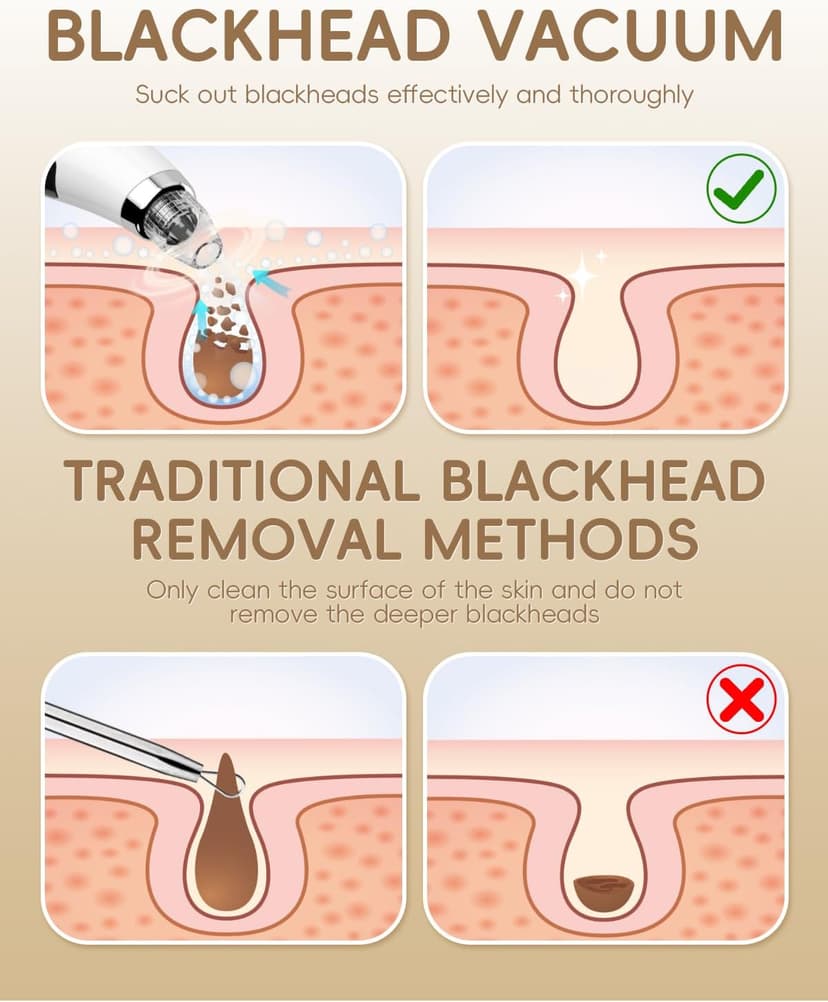 Blackhead Remover Pore Vacuum, Pore Cleaner for Face with 5 Attachments & 3 Suction Levels, USB Rechargeable Facial Blackhead Extractor Tool for Women & Men (Pearl White)
