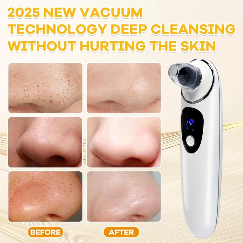 2026 Pore Vacuum with Camerafor, USB Rechargeable Blackhead Remover Vacuum,3 Levels Adjustable Pore Vacuum Blackhead Remover, 6 Suction Heads,Face Vacuum Pore Cleanser for Women & Men-White