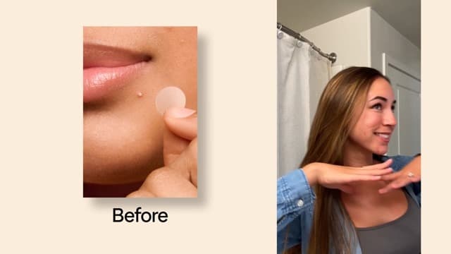 #1 Hydrocolloid Acne Patches, Shrinking Zits & Whiteheads in 1 Use, Spot Treatment, Pimple Stickers for Face Mighty Patch Hero Cosmetics Original Nighttime Acne Pimple Patches, 36 Ct B074PVTPBW
