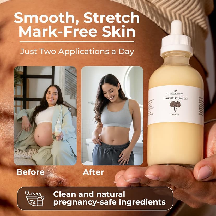 Triple-Weighted Hyaluronic Acid, Centella Asiatica, Supports Hydration & Skin Elasticity, Made in USA in Small Batches 8 Sheep True Belly Serum, Pregnancy-Safe Belly Oil, 4 FL OZ B0FVG9NS7G