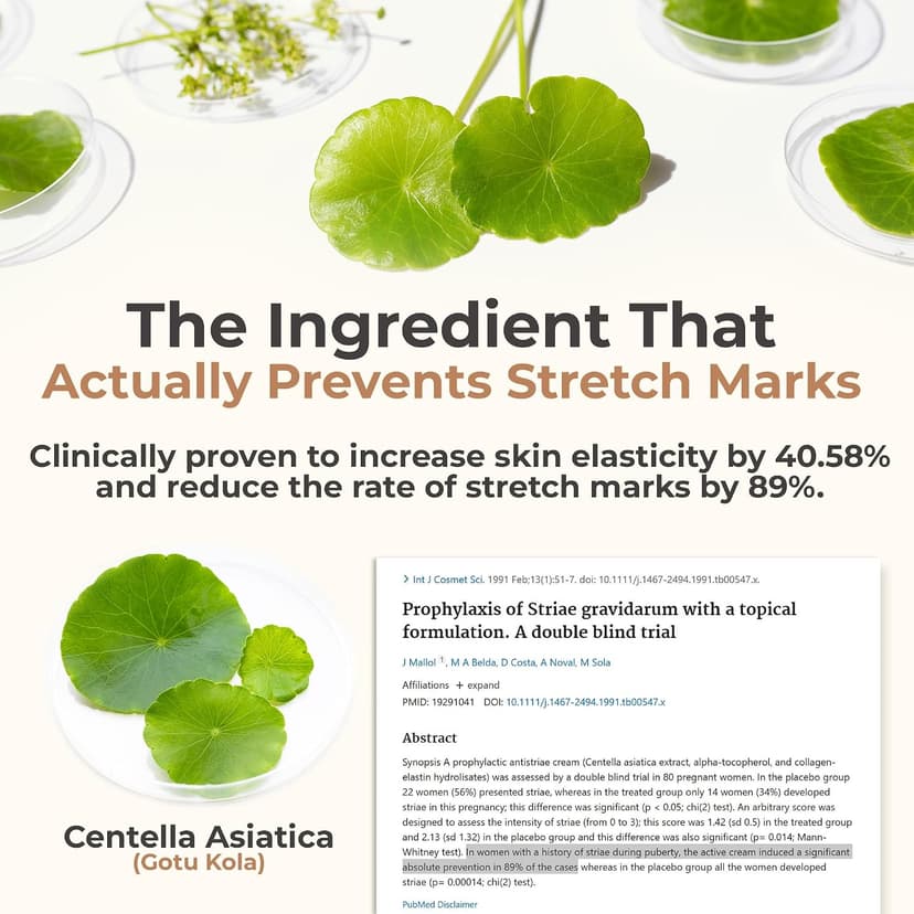 Triple-Weighted Hyaluronic Acid, Centella Asiatica, Supports Hydration & Skin Elasticity, Made in USA in Small Batches 8 Sheep True Belly Serum, Pregnancy-Safe Belly Oil, 4 FL OZ B0FVG9NS7G