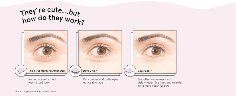 grace & stella Retinol Under Eye Patches for Puffy Eyes & Dark Circles - Restoring Gel Under Eye Masks with Hyaluronic Acid - Christmas Gifts for Teens, Birthday Gifts for Women (Purple, 24 Pairs)