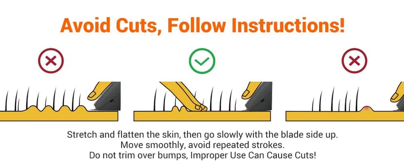 MANSPOT Manscape Groin & Body Hair Trimmer for Men, Electric Ball Pubic Trimmer Shaver,Manscape Kit with 4 Guard,Replaceable Ceramic Blade Heads,Waterproof Wet/Dry Shaver,90 Minutes Shaving