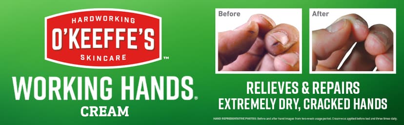 O'Keeffe's Working Hands Hand Cream for Extreme Dryness - 3.4 oz Jar (1 Pack) - Repairing Skincare for Cracked, Dry Hands
