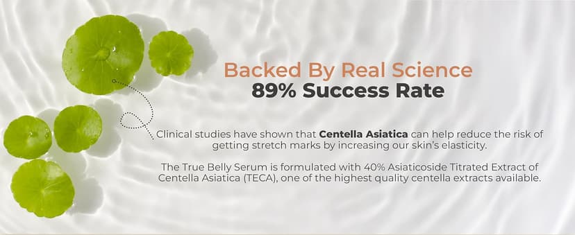 Triple-Weighted Hyaluronic Acid, Centella Asiatica, Supports Hydration & Skin Elasticity, Made in USA in Small Batches 8 Sheep True Belly Serum, Pregnancy-Safe Belly Oil, 4 FL OZ B0FVG9NS7G