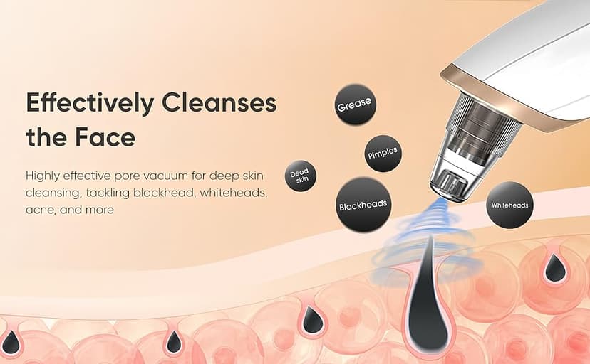 Blackhead Remover Vacuum - Professional Blackhead Extractor for Face with 3 Adjustable Suction Levels, USB Rechargeable Pore Cleaner, and 5 Interchangeable Probes (White)
