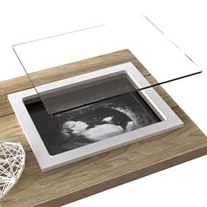 Baby Sonogram Picture Frame with Countdown Weeks - Standard 4"x3" Ultrasound Photo - Pregnancy Announcements Ideas - Gender Reveal Baby-Shower Gift - New Mom Expecting Parents to Be Keepsake Gifts